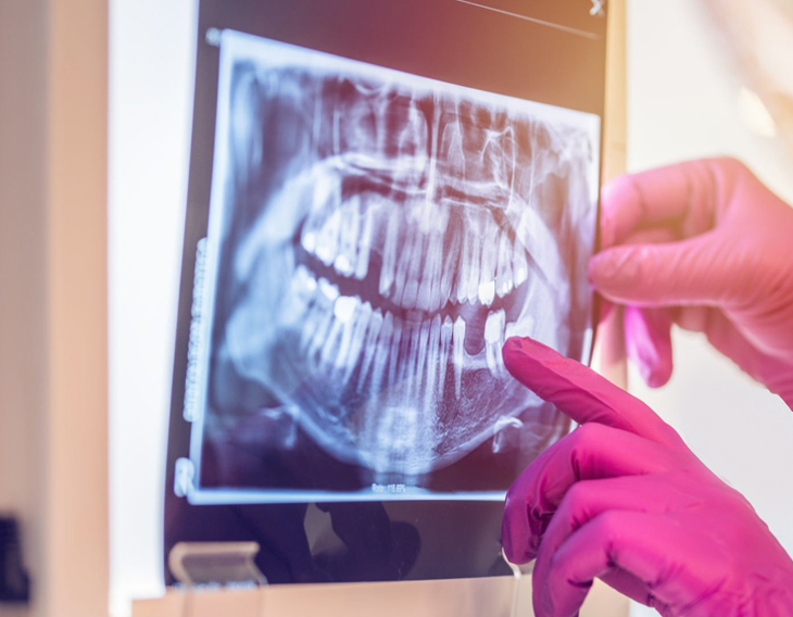 Dentist in pink gloves examining dental X-ray on light box in clinical setting.