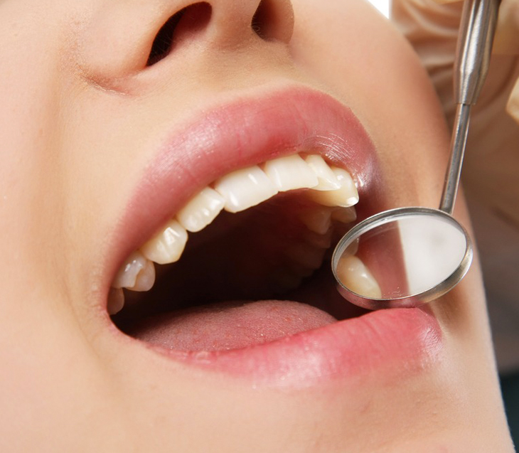 Close-up of patient's open mouth during dental examination with mirror, showing healthy white teeth.