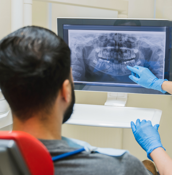 Dentist in blue gloves examines dental X-ray with patient in clinical setting.