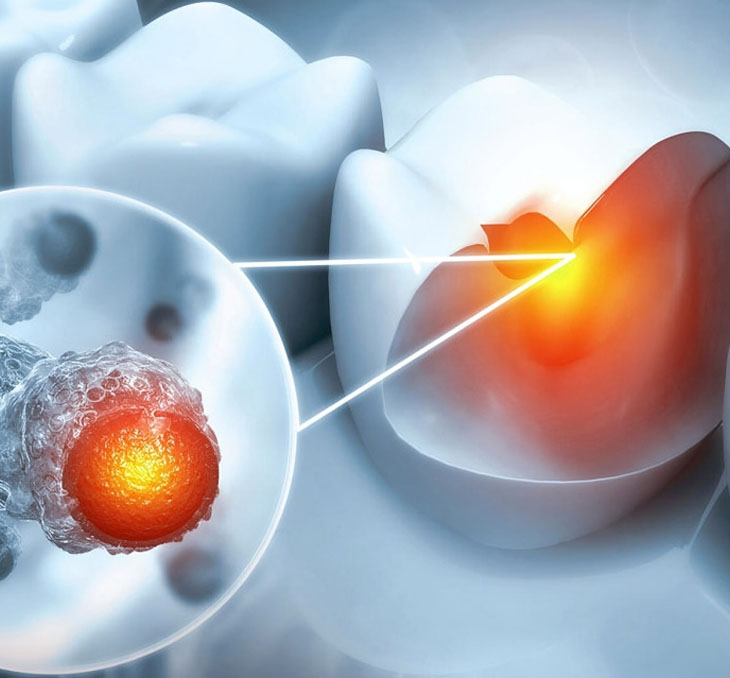 Glowing cells with inflamed nucleus representing dental infection or oral disease at microscopic level.