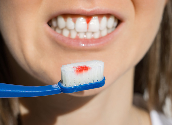 Close-up of toothbrush with red toothpaste against smiling person's teeth and mouth.
